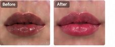 ローマピンクのBefore / After